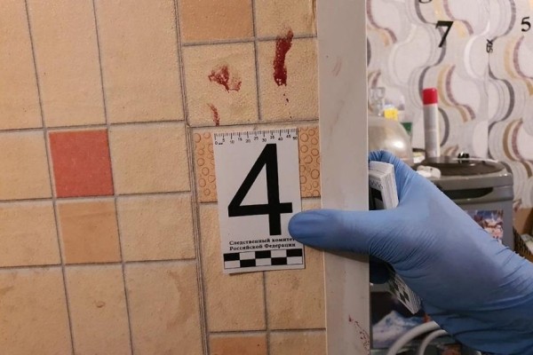 В Кургане молодой человек выжил после нескольких ножевых ранений В Кургане молодой человек выжил после нескольких ножевых ранений